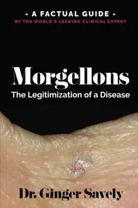 Morgellons: The legitimization of a disease: A Factual Guide by the World’s Leading Clinical Expert