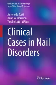 Clinical Cases in Nail Disorders (Clinical Cases in Dermatology)
