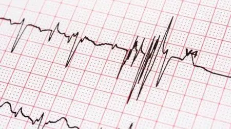 Ecg Guide - Mastering Ecg One Pulse At A Time