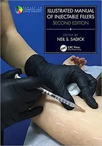 Illustrated Manual of Injectable Fillers, 2nd Edition