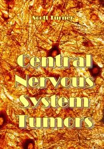 "Central Nervous System Tumors" ed. by Scott Turner