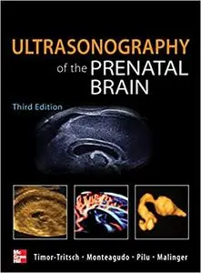 Ultrasonography of the Prenatal Brain, Third Edition