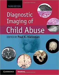 Diagnostic Imaging of Child Abuse Ed 3