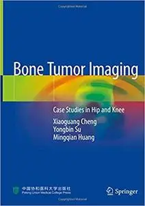 Bone Tumor Imaging: Case Studies in Hip and Knee