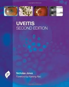 Uveitis, 2 edition
