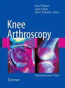 Knee Arthroscopy