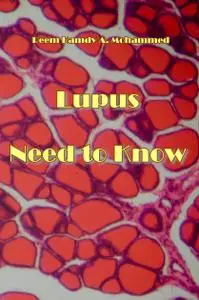 "Lupus: Need to Know" ed. by Reem Hamdy A. Mohammed