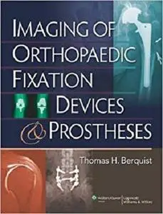 Imaging of Orthopaedic Fixation Devices and Prostheses [Repost]