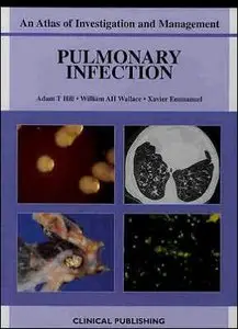 Pulmonary Infection: An Atlas of Investigation and Management (repost)