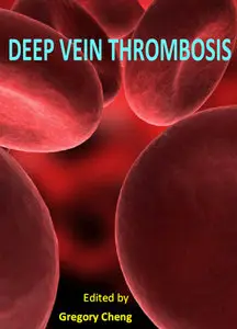 "Deep Vein Thrombosis" ed. by Gregory Cheng
