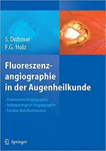 Fluoreszenzangiographie in der Augenheilkunde: Fluoreszein-Angiographie, Indozyaningrün-Angiographie und Fundus-Autofluoreszenz