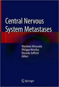 Central Nervous System Metastases
