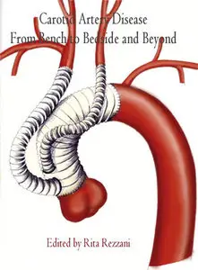 "Carotid Artery Disease: From Bench to Bedside and Beyond" ed. by Rita Rezzani