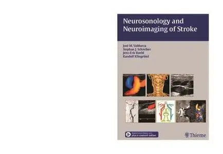 Neurosonology and Neuroimaging of Stroke Book / DVD