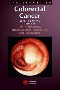 Challenges in colorectal cancer (Repost)