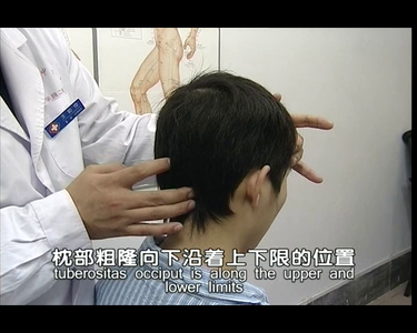 Chinese Massage DVD - Massage and Rehabilitation Exercise of the Cervical Spondylosis