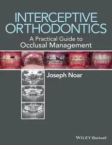 Interceptive Orthodontics: A Practical Guide to Occlusal Management (repost)