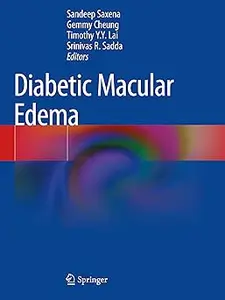 Diabetic Macular Edema