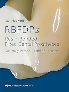 RBFDPs: Resin-Bonded Fixed Dental Prostheses: Minimally Invasive - Esthetic - Reliable