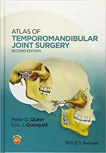 Atlas of Temporomandibular Joint Surgery Ed 2