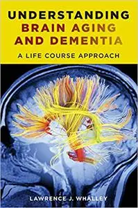 Understanding Brain Aging and Dementia: A Life Course Approach (Repost)