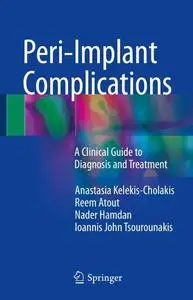 Peri-Implant Complications: A Clinical Guide to Diagnosis and Treatment (Repost)
