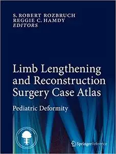 Limb Lengthening and Reconstruction Surgery Case Atlas: Pediatric Deformity