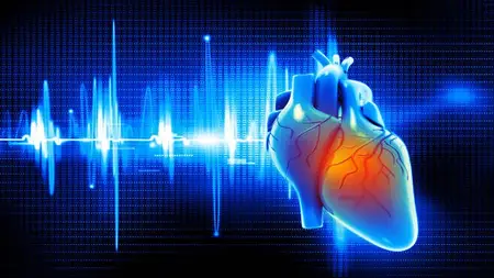 Coronary Artery Disease  (CAD)