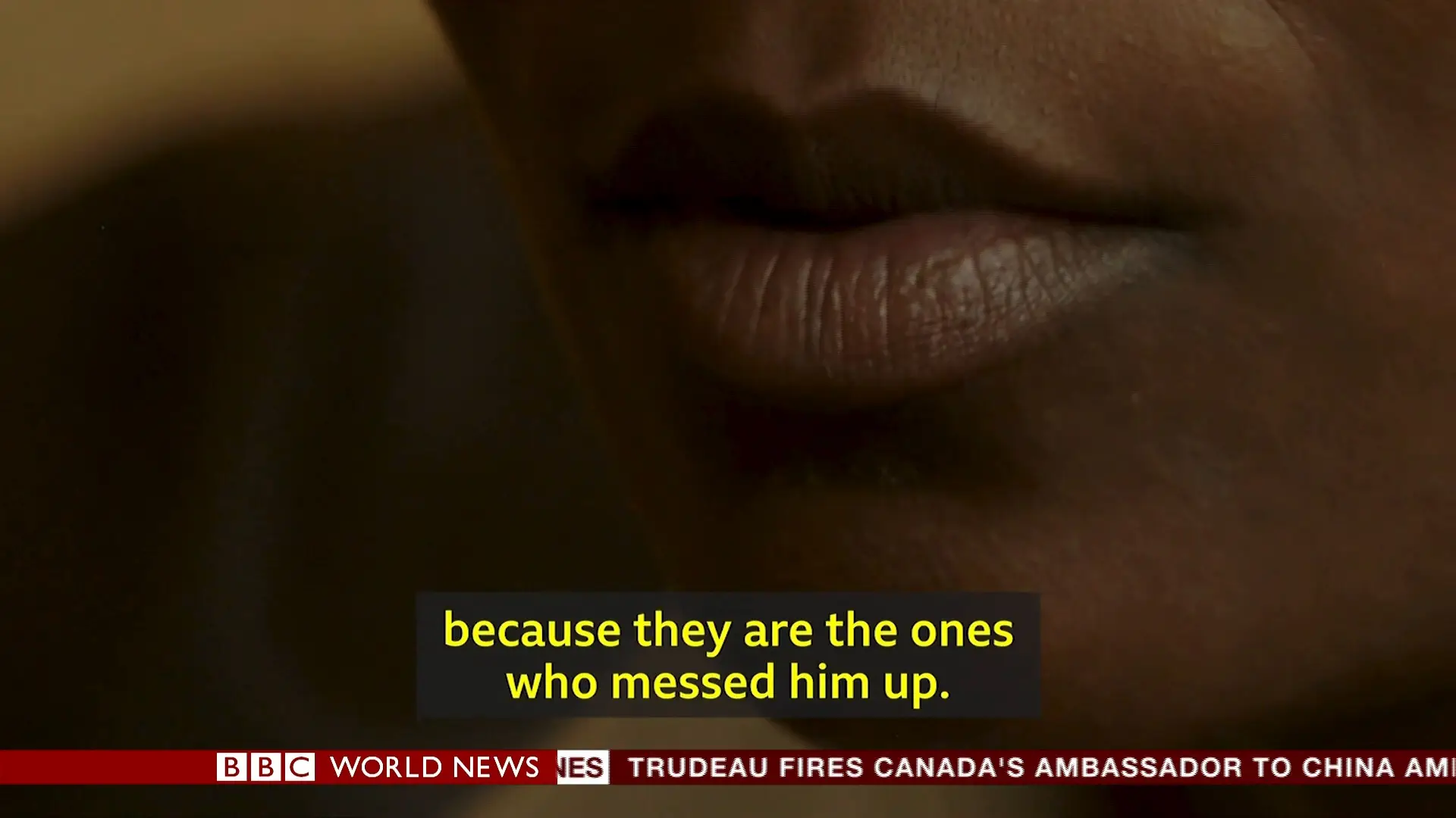 BBC - Intersex Surgeries: Who Chooses My Body? (2019)