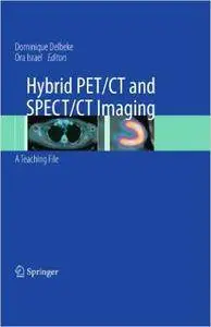 Hybrid PET/CT and SPECT/CT Imaging: A Teaching File