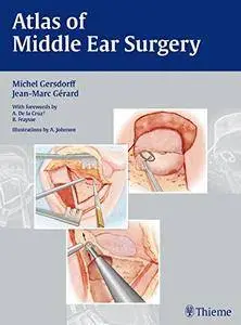 Atlas of Middle Ear Surgery