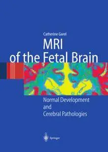 MRI of the Fetal Brain: Normal Development and Cerebral Pathologies