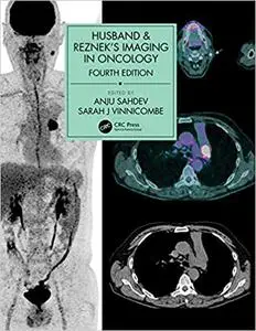 Husband & Reznek's Imaging in Oncology Ed 4