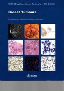 Breast Tumours: WHO Classification of Tumours (Medicine)