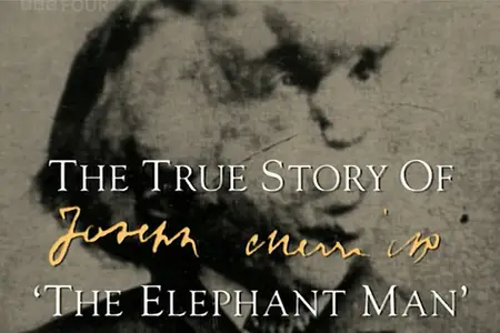 BBC - The True Story of the Elephant Man (1997)