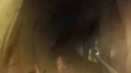 Attack on Titan S01E21