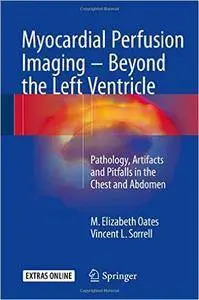 Myocardial Perfusion Imaging - Beyond the Left Ventricle
