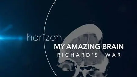 BBC Horizon - My Amazing Brain: Richard's War (2018)