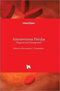 Arteriovenous Fistulas: Diagnosis and Management