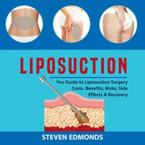 «Liposuction: You Guide to Liposuction Surgery Costs, Benefits, Risks, Side Effects & Recovery» by Steven Edmonds