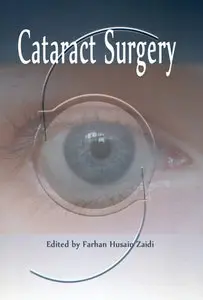 "Cataract Surgery" ed. by Farhan Husain Zaidi