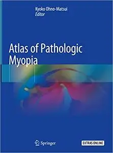 Atlas of Pathologic Myopia