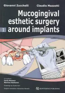 Mucogingival Esthetic Surgery around Implants (VOL 1)