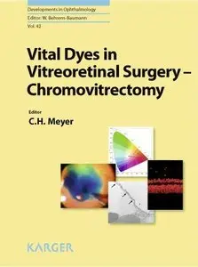 Vital Dyes in Vitreoretinal Surgery: Chromovitrectomy (repost)