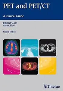 PET and PET/CT: a clinical guide