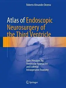 Atlas of Endoscopic Neurosurgery of the Third Ventricle: Basic Principles for Ventricular Approaches and Essential Intraoperati