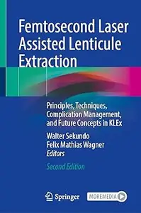 Femtosecond Laser Assisted Lenticule Extraction: Principles, Techniques, Complication Management, and Future Concepts in