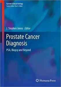 Prostate Cancer Diagnosis: PSA, Biopsy and Beyond