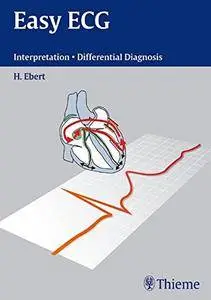 Easy ECG: Interpretation Differential Diagnoses