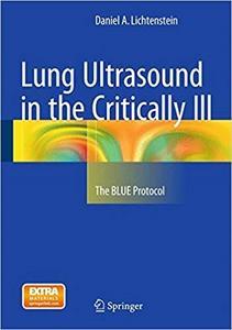 Lung Ultrasound in the Critically Ill: The BLUE Protocol (repost)